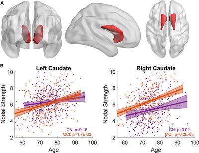 Sex Modulates the Pathological Aging Effect on Caudate Functional Connectivity in Mild Cognitive Impairment